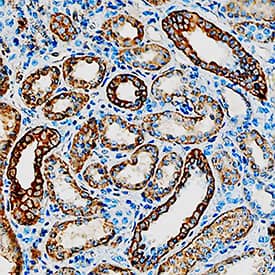 11 beta-HSD2 antibody in Human Kidney by Immunohistochemistry (IHC-P).