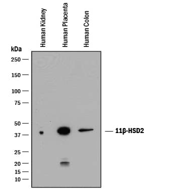 Detection of Human 11 beta-HSD2 antibody by Western Blot.