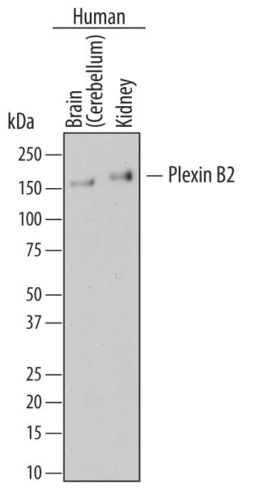 Detection of Human Plexin B2 antibody by Western Blot.