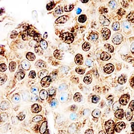 Cyclin E2 antibody in Human Breast by Immunohistochemistry (IHC-P).