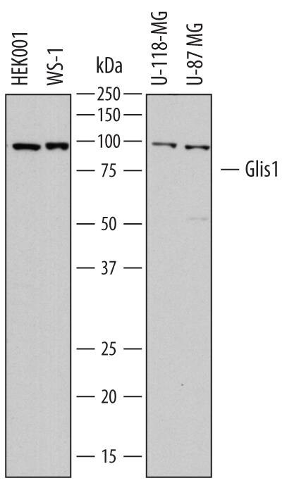 Detection of Human Glis1 antibody by Western Blot.