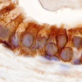PSCA antibody in Human Prostate by Immunohistochemistry (IHC-P).