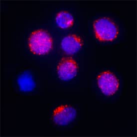 GRK5 antibody in BJAB Human Cell Line by Immunocytochemistry (ICC).