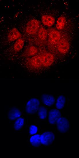 ARNT/HIF-1 beta antibody in MCF-7 Human Cell Line by Immunocytochemistry (ICC).