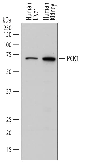 Detection of Human PCK1 antibody by Western Blot.