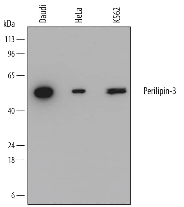 Detection of Human Perilipin-3 antibody by Western Blot.