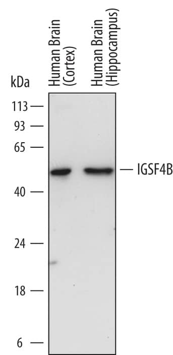 Detection of Human IGSF4B/SynCAM3 antibody by Western Blot.