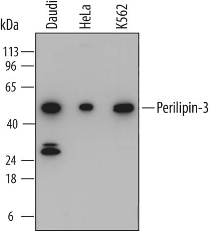 Detection of Human Perilipin-3 antibody by Western Blot.