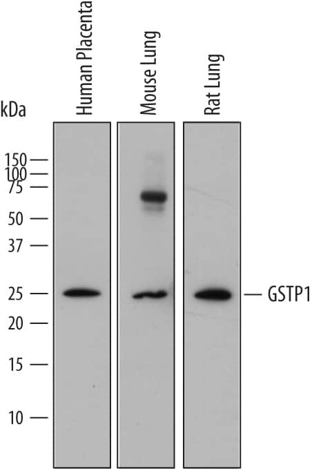 Detection of Human, Mouse, and Rat Glutathione S-Transferase pi 1/GSTP1 antibody by Western Blot.