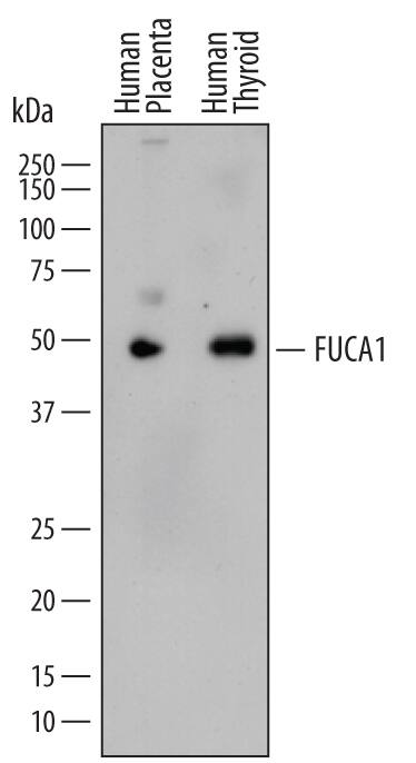 Detection of Human Tissue a-L-Fucosidase/FUCA1 antibody by Western Blot.