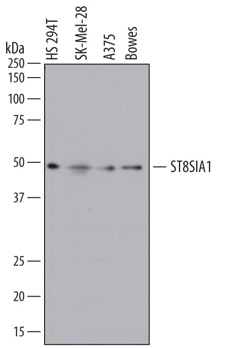 Detection of Human ST8 a-2,8-Sialyltransferase 8A/ ST8SIA1 antibody by Western Blot.