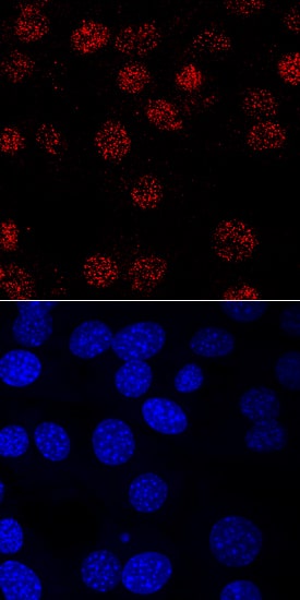 MYF-5 antibody in C2C12 Mouse Cell Line by Immunocytochemistry (ICC).