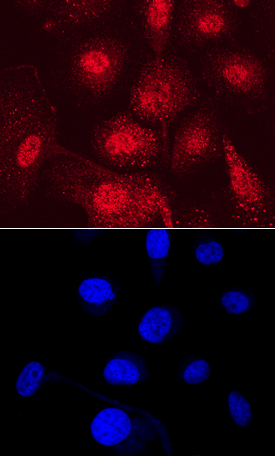 PDZD2 antibody in PC-3 Human Cell Line by Immunocytochemistry (ICC).