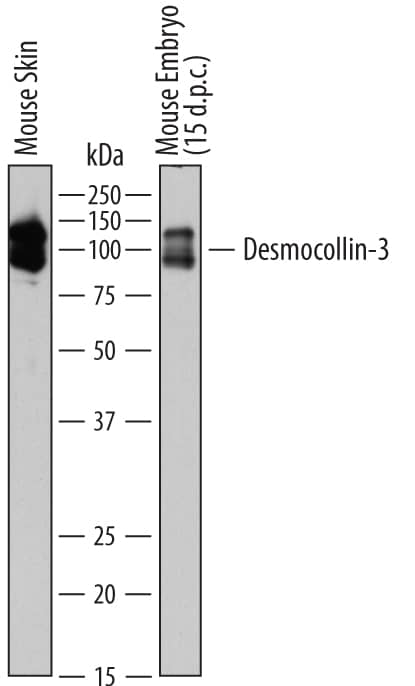 Detection of Mouse Desmocollin-3 antibody by Western Blot.