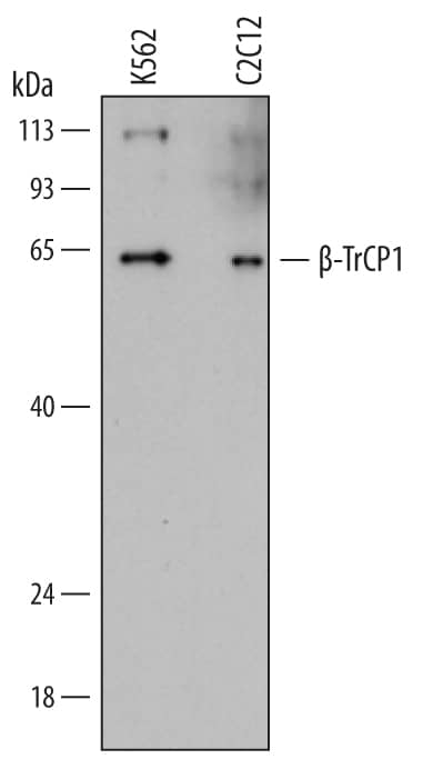 Detection of Human and Mouse  beta-TrCP1/BTRC antibody by Western Blot.