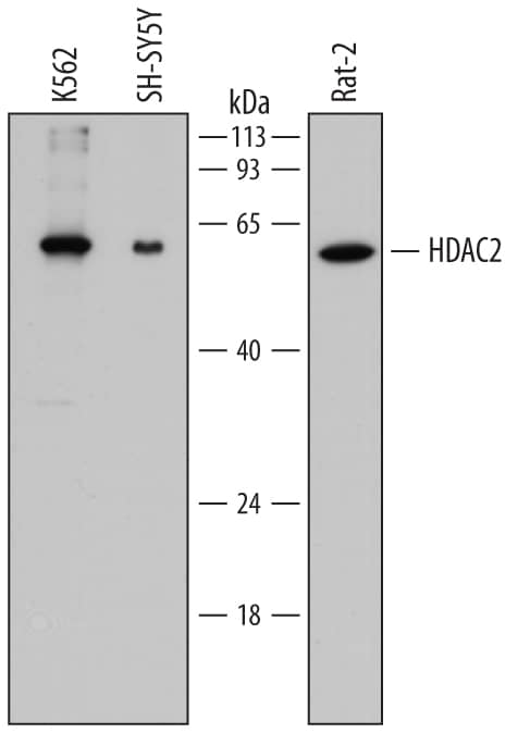 Detection of Human and Rat Histone Deacetylase 2/HDAC2 antibody by Western Blot.