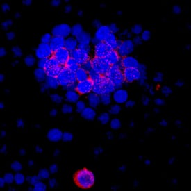 IL-17F antibody in Rat Splenocytes by Immunocytochemistry (ICC).