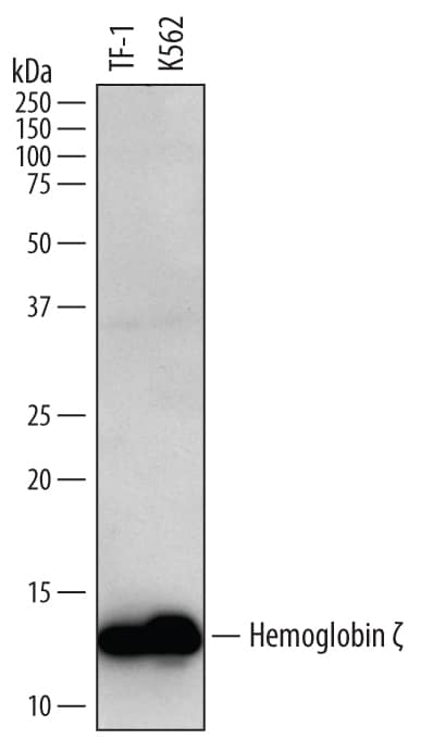 Detection of Human Hemoglobin ? antibody by Western Blot.