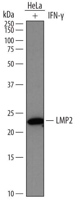 Detection of Human LMP2/PSMB9 antibody by Western Blot.