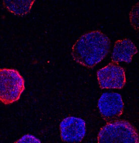 Hemoglobin ? antibody in K562 Human Cell Line by Immunocytochemistry (ICC).