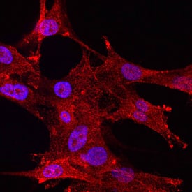 Allergin-1 antibody in U-87 MG Human Cell Line by Immunocytochemistry (ICC).