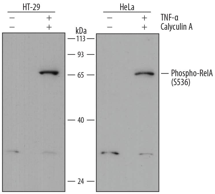 Detection of Human Phospho-RelA/NF?B p65 (S536) antibody by Western Blot.