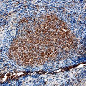 IRF8 antibody in Human Tonsil by Immunohistochemistry (IHC-P).