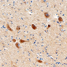 ALK/CD246 antibody in Human Brain by Immunohistochemistry (IHC-P).