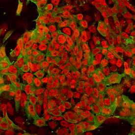 UTF1 antibody in D3 Mouse Stem Cells by Immunocytochemistry (ICC).