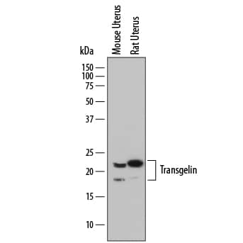 Detection of Mouse and Rat Transgelin/TAGLN antibody by Western Blot.