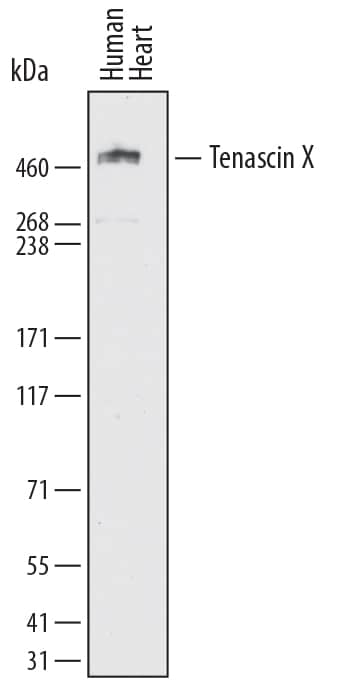 Detection of Human Tenascin X antibody by Western Blot.