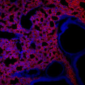 RAGE antibody in Mouse Lung by Immunohistochemistry (IHC-Fr).