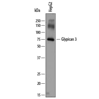 Detection of Human Glypican 3 antibody by Western Blot.