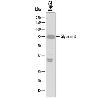 Detection of Human Glypican 3 antibody by Western Blot.
