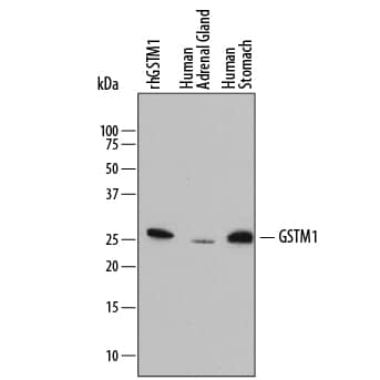 Detection of Human Glutathione S-Transferase mu 1/GS antibody by Western Blot.