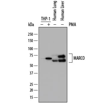 Detection of Human MARCO antibody by Western Blot.