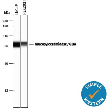 Detection of Human Glucosylceramidase/GBA antibody by Simple WesternTM.