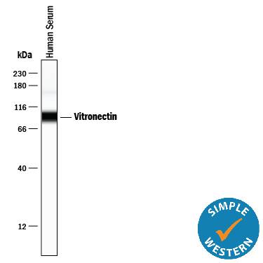 Detection of Human Vitronectin antibody by Simple WesternTM.