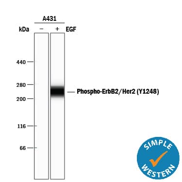 Detection of Human Phospho-ErbB2/Her2 (Y1248) antibody by Simple WesternTM.