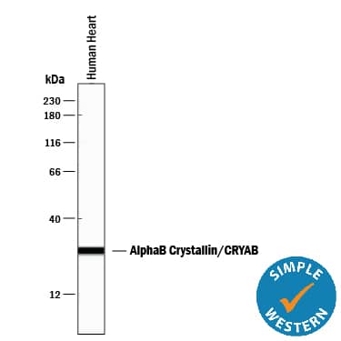Detection of Human AlphaB Crystallin/CRYAB antibody by Simple WesternTM.