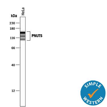 Detection of Human PNUTS antibody by Simple WesternTM.