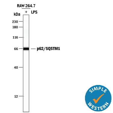 Detection of Mouse p62/SQSTM1 antibody by Simple WesternTM.