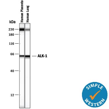 Detection of Human ALK-1 antibody by Simple WesternTM.