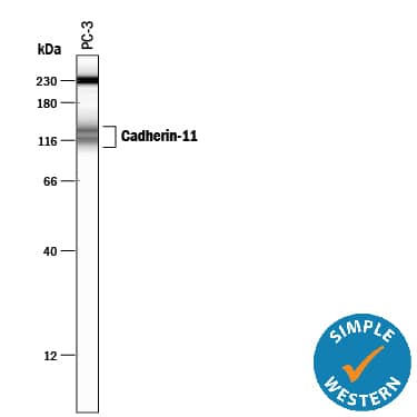 Detection of Human Cadherin-11 antibody by Simple WesternTM.
