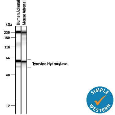 Detection of Human and Mouse Tyrosine Hydroxylase antibody by Simple WesternTM.
