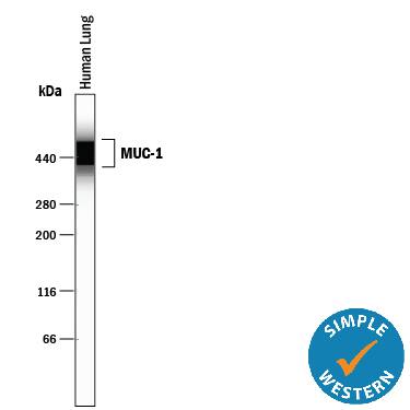 Detection of Human MUC-1 antibody by Simple WesternTM.