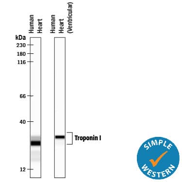 Detection of Human Troponin I antibody by Simple WesternTM.