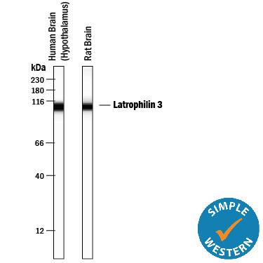 Detection of Human and Rat Latrophilin 3/LPHN3 antibody by Simple WesternTM.