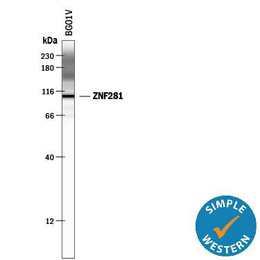 Detection of Human ZNF281 antibody by Simple WesternTM.