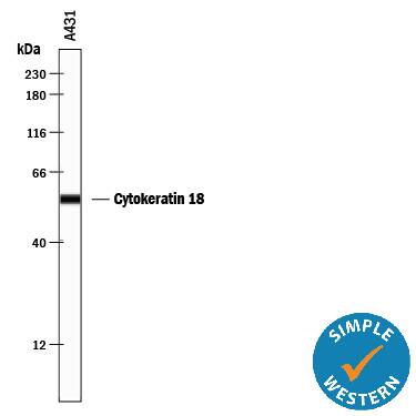 Detection of Human Cytokeratin 18 antibody by Simple WesternTM.
